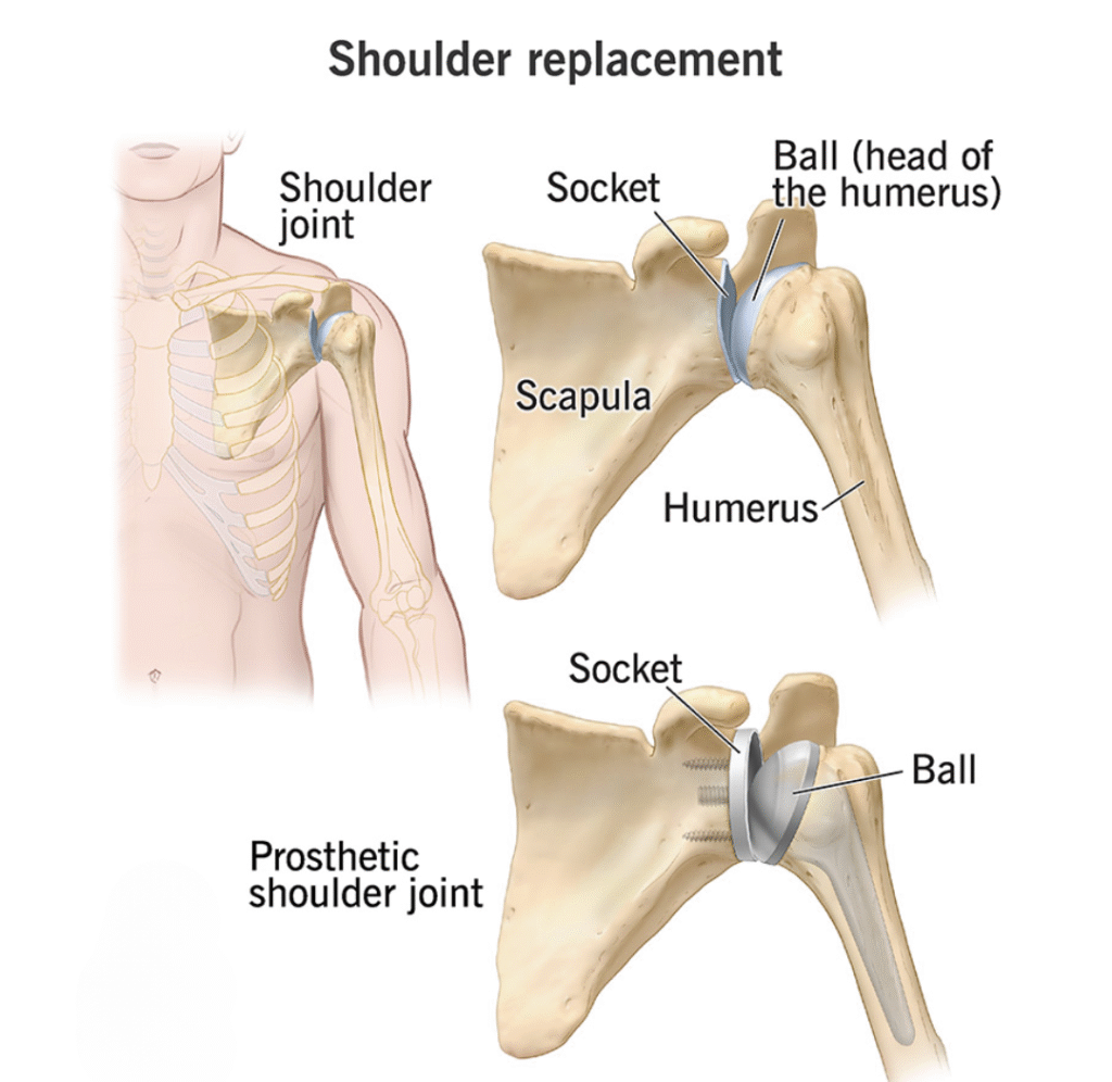 Shoulder Treatment
